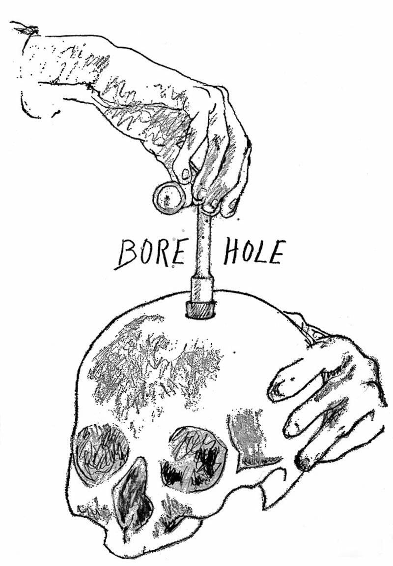brain hole: not exactly as illustrated