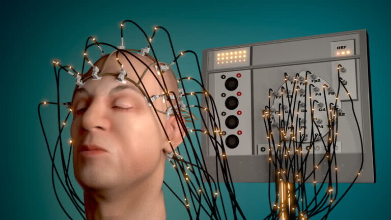 Read more about the article EEG brain scan