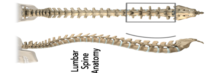 Read more about the article Results of lower back MRI